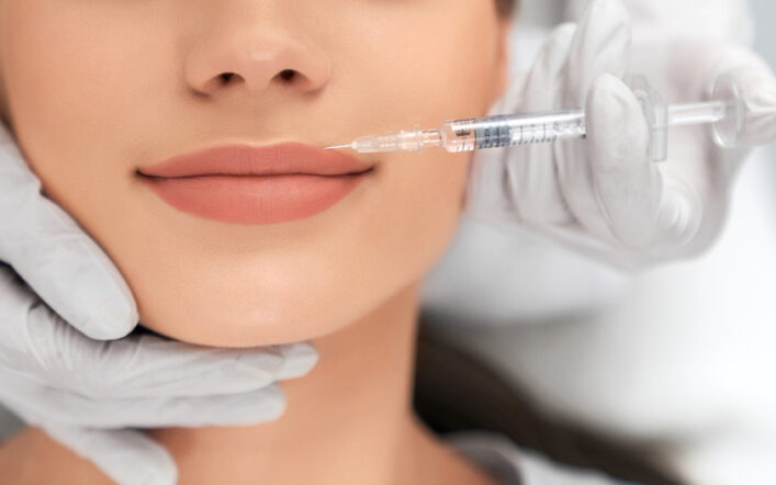 Il Botox Labbra: Definizione, Procedure e Risultati