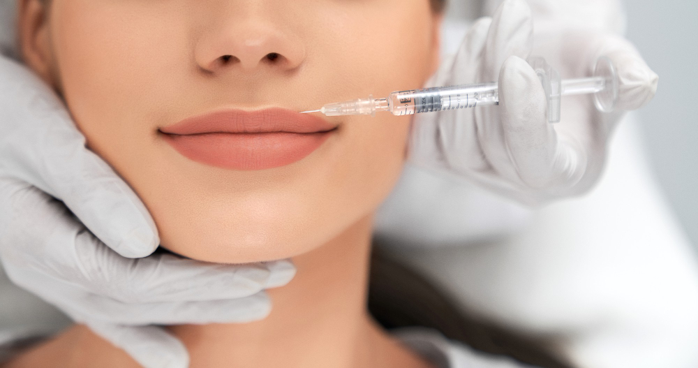 Il Botox Labbra: Definizione, Procedure e Risultati
